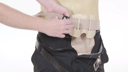 ostomy protector