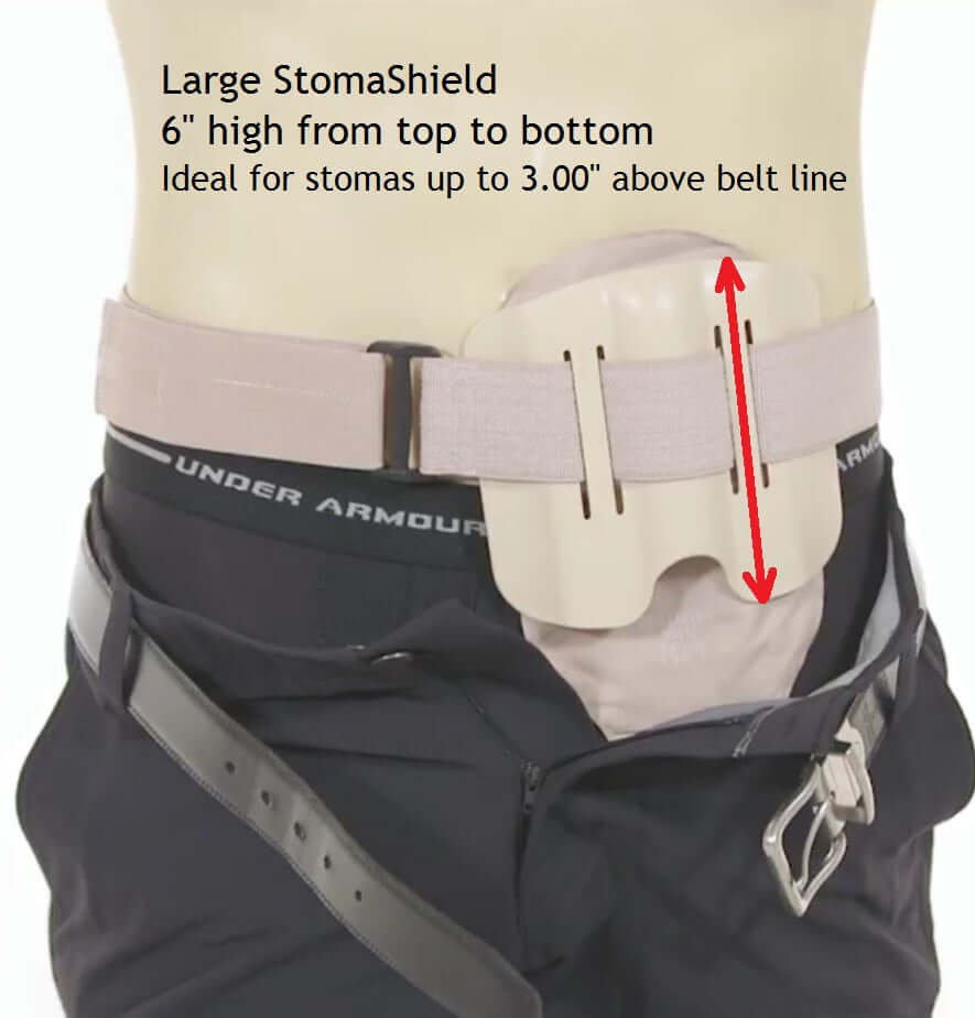 StomaShield Stoma Guard sizing